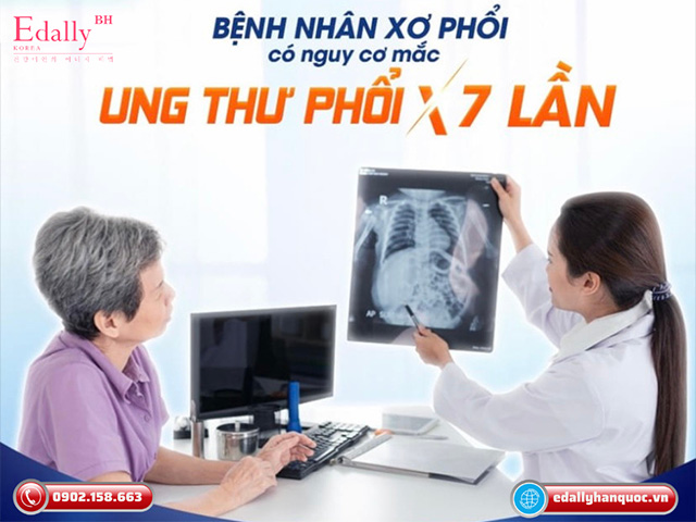 Bệnh nhân xơ phổi có nguy cơ mắc ung thư phổi cao gấp 7 lần