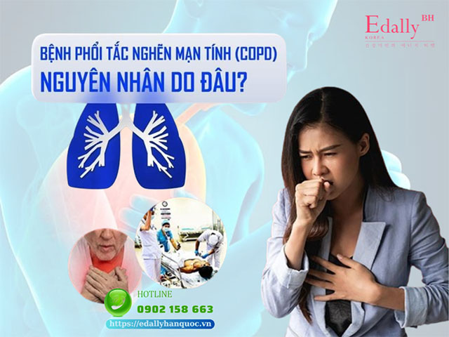 Bệnh phổi tắc nghẽn mãn tính (COPD) - Nguyên nhân, triệu chứng và cách phòng ngừa, điều trị hiệu quả