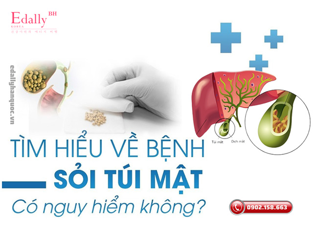 Bệnh sỏi túi mật có nguy hiểm không?