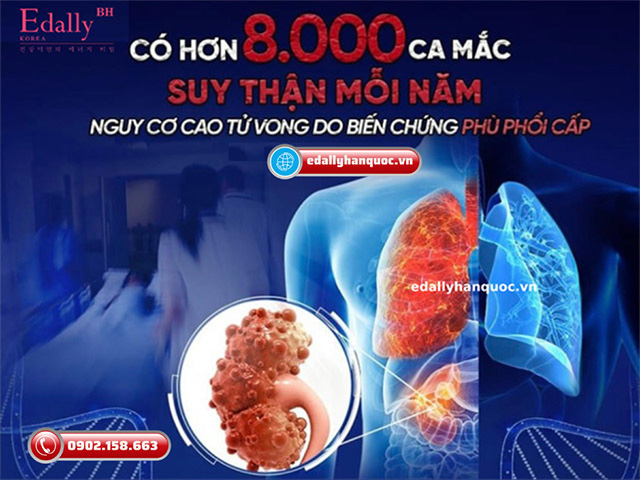 Mỗi năm có 8000 ca mắc bệnh suy thận nguy cơ cao tử vong do biến chứng phù phổi cấp