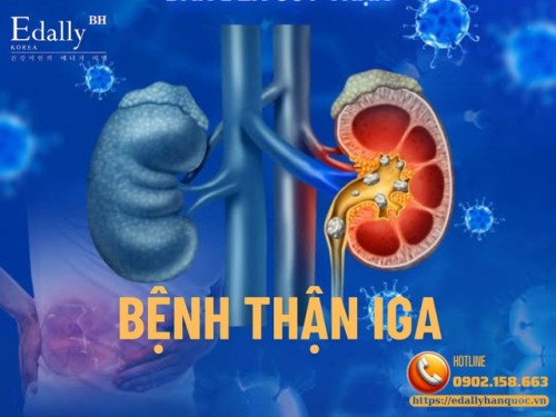 Bệnh Thận IgA Có Ghép Được Không, Nên Ghép Khi Nào, Có Tái Phát Sau Ghép Không, Điều Trị Khi Tái Phát Ra Sao?