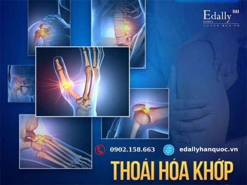 Thoái Hóa Khớp - Bệnh Không Lây Hàng Đầu Gây Tàn Phế