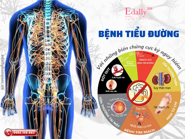 Bệnh tiểu đường với những biến chứng cực kỳ nguy hiểm