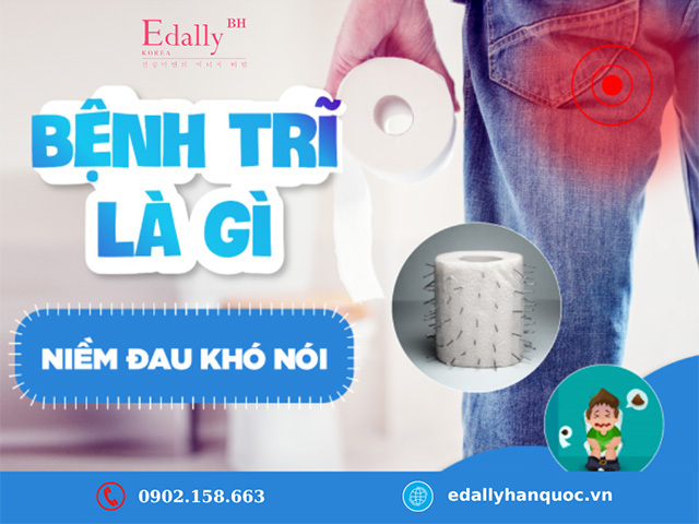 Bệnh trĩ là bệnh gì? Cách điều trị bệnh trĩ tại nhà thế nào?