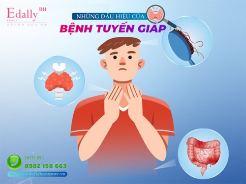 Bệnh Tuyến Giáp - Một Số Điều Cần Biết