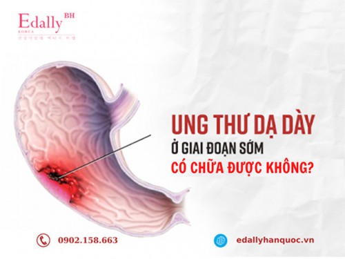 Ung Thư Dạ Dày Giai Đoạn Đầu Có Chữa Được Không?