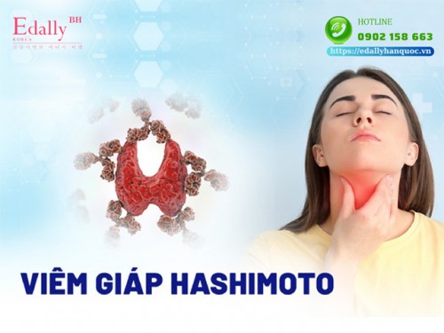 6 Vi Chất Quan Trọng Cho Người Viêm Giáp Tự Miễn Hashimoto’s