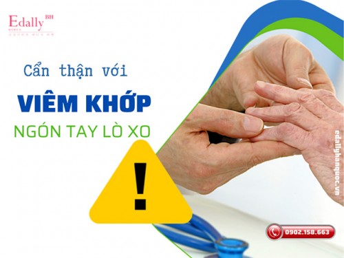 Bệnh Viêm Khớp Ngón Tay Lò Xo Có Nguy Hiểm Không?