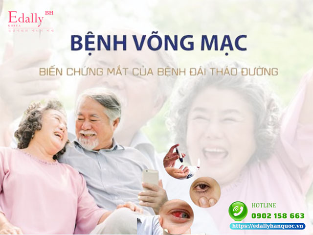 Bệnh võng mạc đái tháo đường - Nguyên nhân, triệu chứng và cách phòng ngừa, điều trị hiệu quả