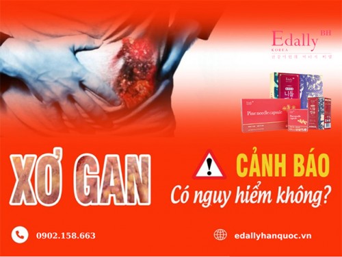 Bệnh Xơ Gan Có Nguy Hiểm Không?