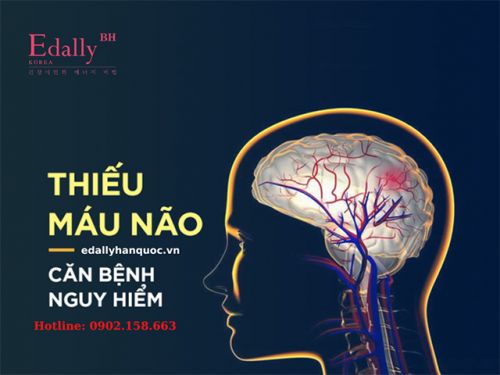 Thiếu Máu Não Ở Người Trẻ Tuổi - Xin Đừng Chủ Quan