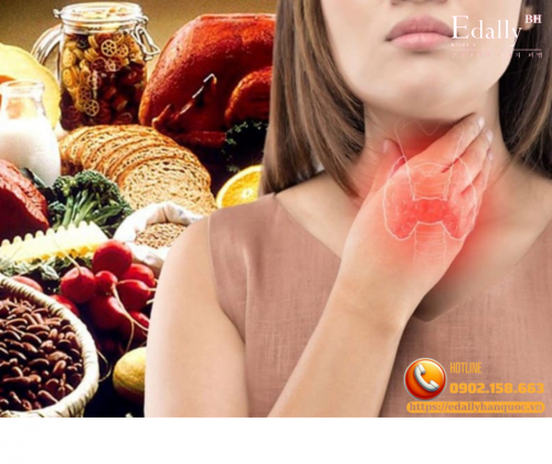Bệnh Nhân Có Bướu Nhân Tuyến Giáp Nên Ăn Uống Gì Để Tiêu U?