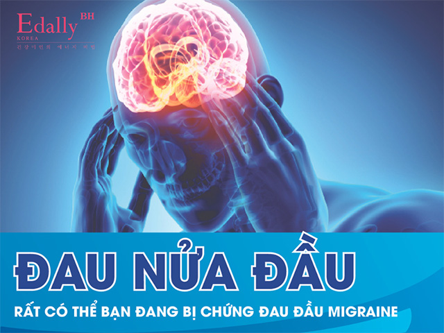 Đau nửa đầu rất có thể bạn đã mắc chứng đau đầu Migraine