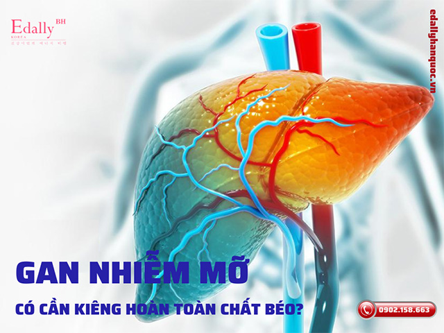 Người bị bệnh gan nhiễm mỡ có cần kiêng hoàn toàn chất béo không?