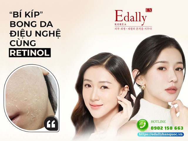 Bí kíp bong da điệu nghệ cùng Retinol