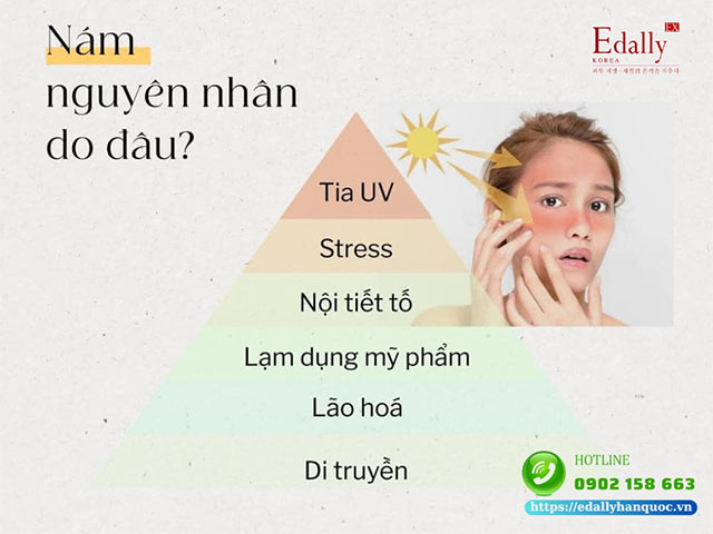 Bị nám da mặt nguyên nhân do đâu?