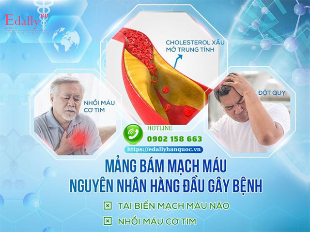 Bị nhồi máu cơ tim nguyên nhân do đâu?