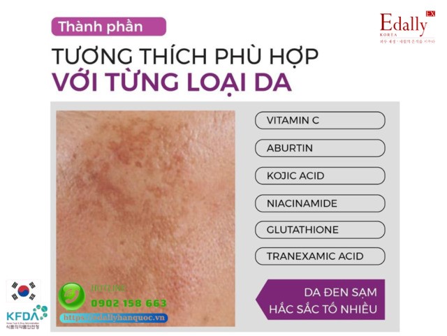 Cách lựa chọn thành phần mỹ phẩm phù hợp với làn da đen sạm, hắc sắc tố nhiều