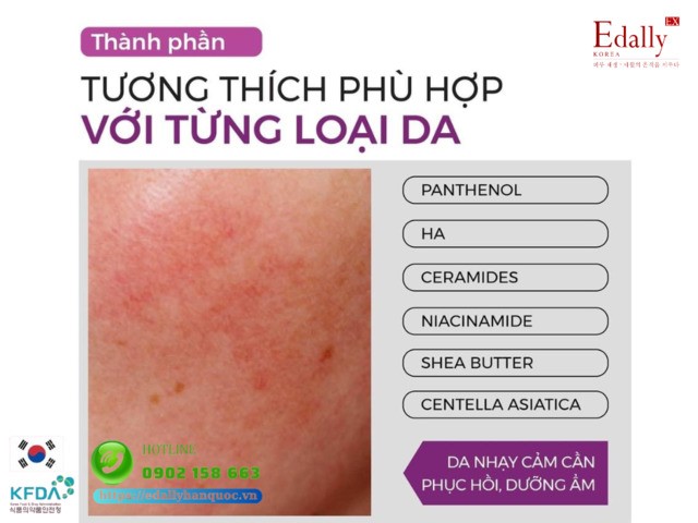 Cách lựa chọn thành phần mỹ phẩm phù hợp với làn da nhạy cảm cần phục hồi, dưỡng ẩm