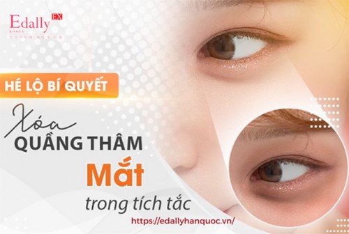 Cách Khắc Phục Quầng Thâm Mắt Hiệu Quả Tại Nhà