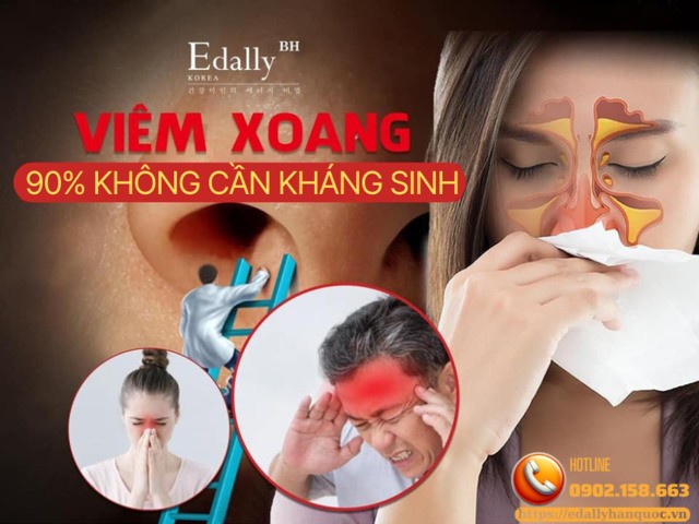 90% Viêm Xoang Không Cần Kháng Sinh - Bạn Có Đang Lạm Dụng? 