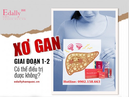 Bị Xơ Gan Giai Đoạn Đầu Có Chữa Được Không?