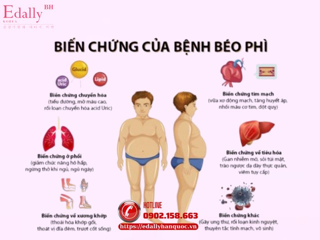 Biến chứng của bệnh béo phì nguy hiểm như thế nào?