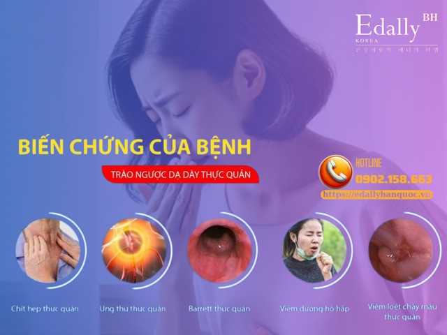 Trào ngược dạ dày - thực quản (GERD( nguy hiểm như thế nào?