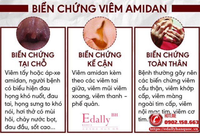 Biến chứng của viêm amidan