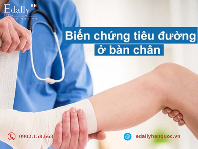 Biến chứng bàn chân đái tháo đường có thể gây những vết loét khó lành