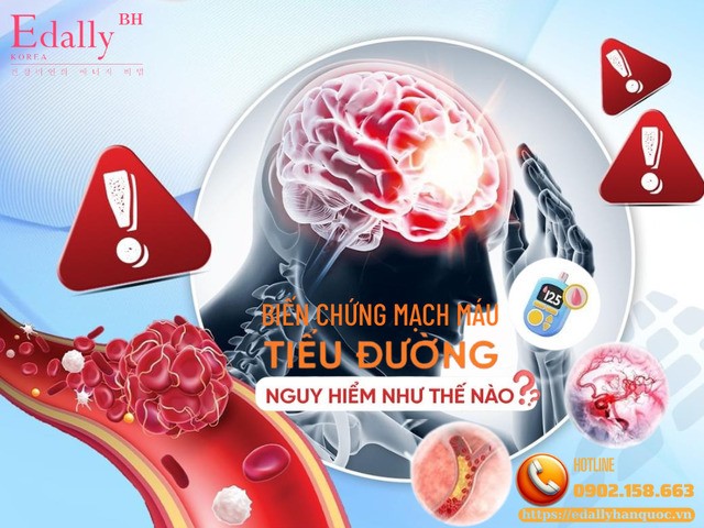 Biến chứng mạch máu - hậu quả đắt đỏ nhất của bệnh tiểu đường
