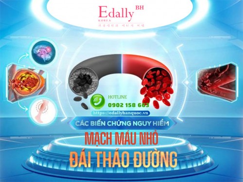 Biến Chứng Mạch Máu Nhỏ Ở Người Tiểu Đường & Các Ảnh Hưởng Nguy Hiểm Đến Mắt, Tim Mạch, Thận… 