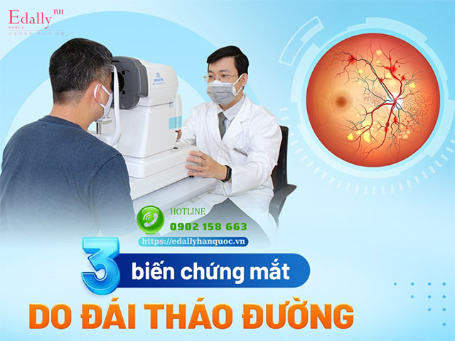 Những biến chứng nguy hiểm ở mắt của bệnh tiểu đường lâu năm là gì?