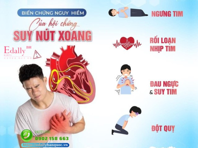 Bệnh suy nút xoang có nguy hiểm không?