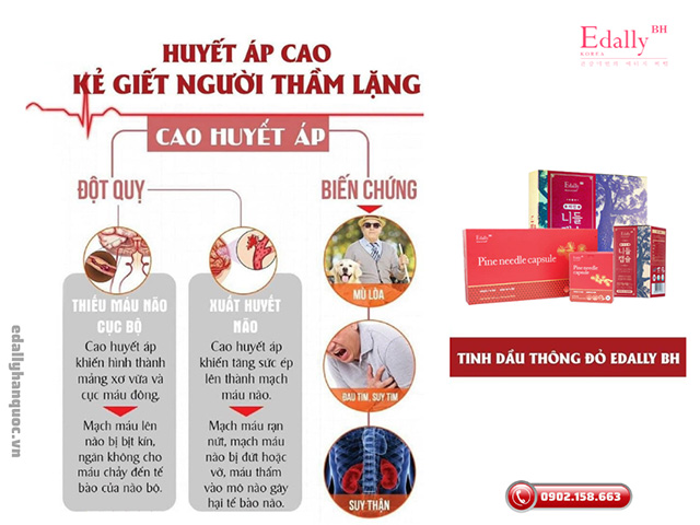 Các biến chứng nguy hiểm của bệnh tăng huyết áp thứ phát gây ra