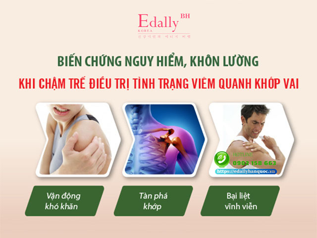 Những biến chứng khôn lường khi chậm trễ điều trị tình trạng viêm quanh khớp vai