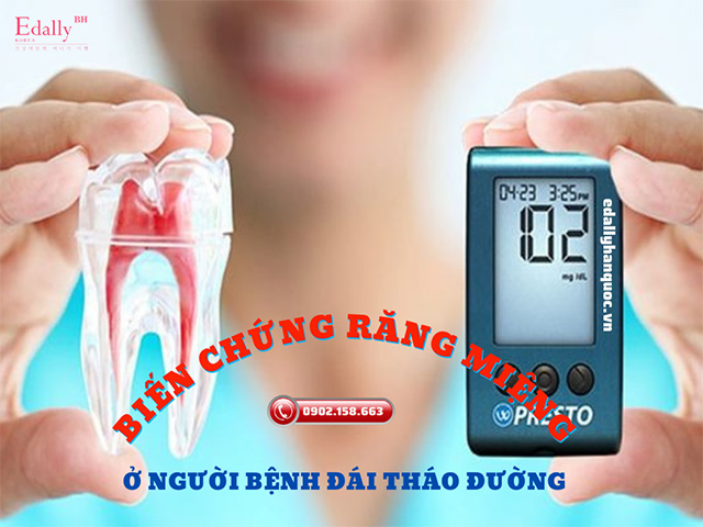 Biến chứng răng miệng ở người đái tháo đường là nguyên nhân chính dẫn đến lung lay và mất răng