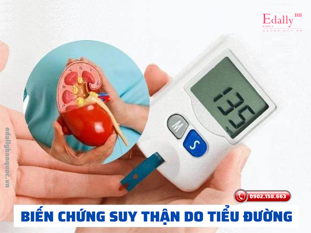 Biến chứng suy thận ở người bệnh đái tháo đường có nguy hiểm không?