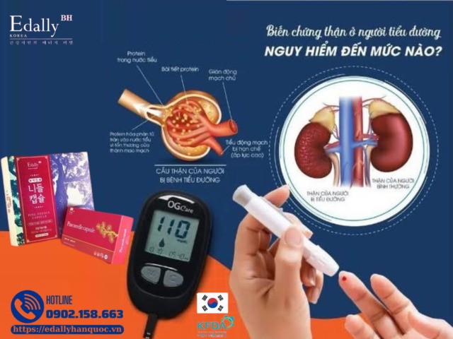 Biến Chứng Thận Ở Người Tiểu Đường - Những Điều Cần Biết