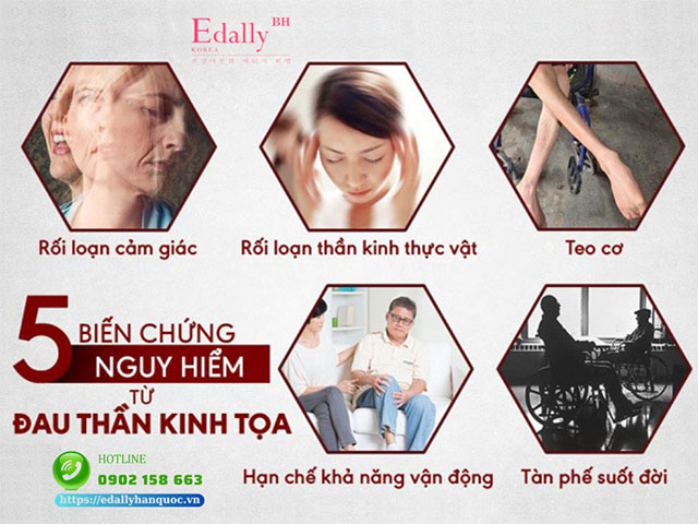 Những biến chứng nguy hiểm từ đau thần kinh tọa