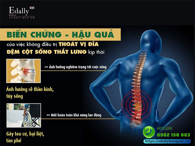 Các biến chứng nguy hiểm và hậu quả của Thoát vị đĩa đệm cột sống thắt lưng và chứng đau thần kinh tọa