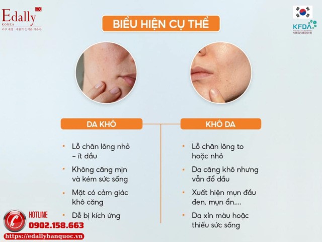 Biểu hiện của da khô và khô da