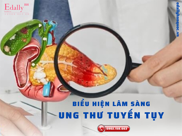 Biểu hiện lâm sàng của bệnh ung thư tuyến tụy là gì?