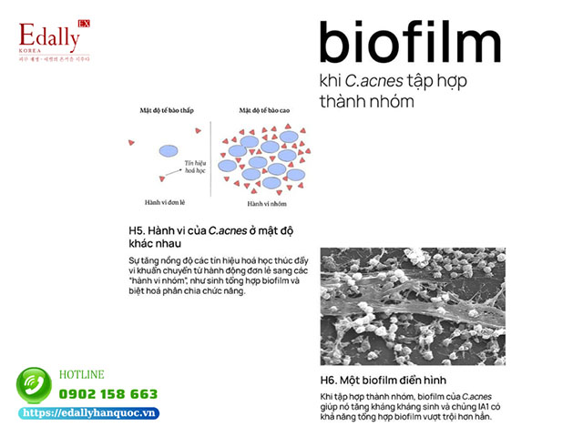 Biofilm khi vi khuẩn gây mụn C.acnes tập hợp thành nhóm