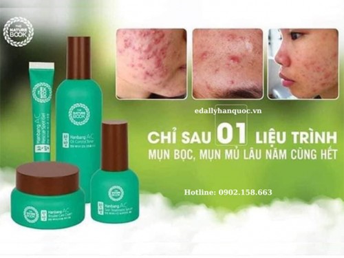 Review Bộ Sản Phẩm Trị Mụn Đông Y Hàn Quốc The Nature Book