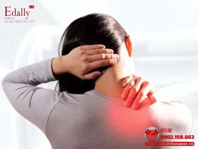 Căng cơ hoặc bong gân vùng cổ và cách điều trị, phòng ngừa hiệu quả Căng cơ hoặc bong gân vùng cổ và cách điều trị, phòng ngừa hiệu quả