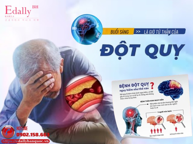 Buổi sáng là giờ tử thần của đột quỵ Buổi sáng là giờ tử thần của đột quỵ