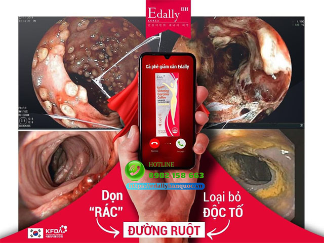 Cà phê thải độc giảm cân Edally Super Slimming Garcinia Cofee - Don rác đường ruột, loại bỏ độc tố