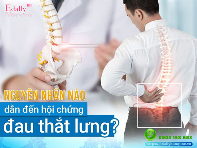 Các bệnh lý cơ xương khớp nào gây đau thắt lưng?