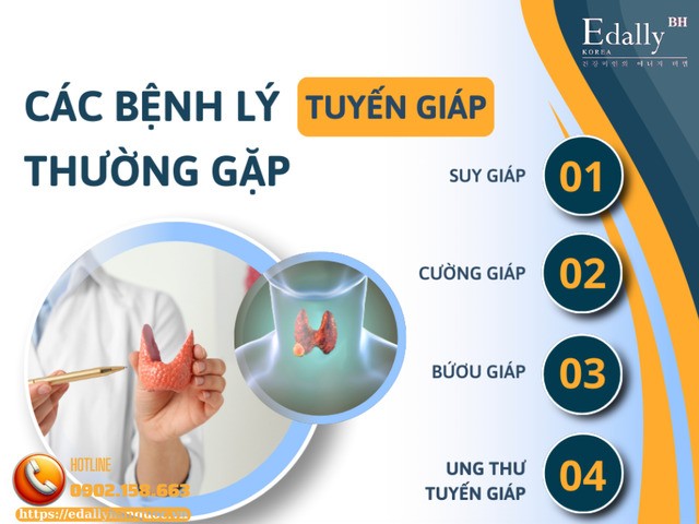 Các bệnh lý tuyến giáp thường gặp